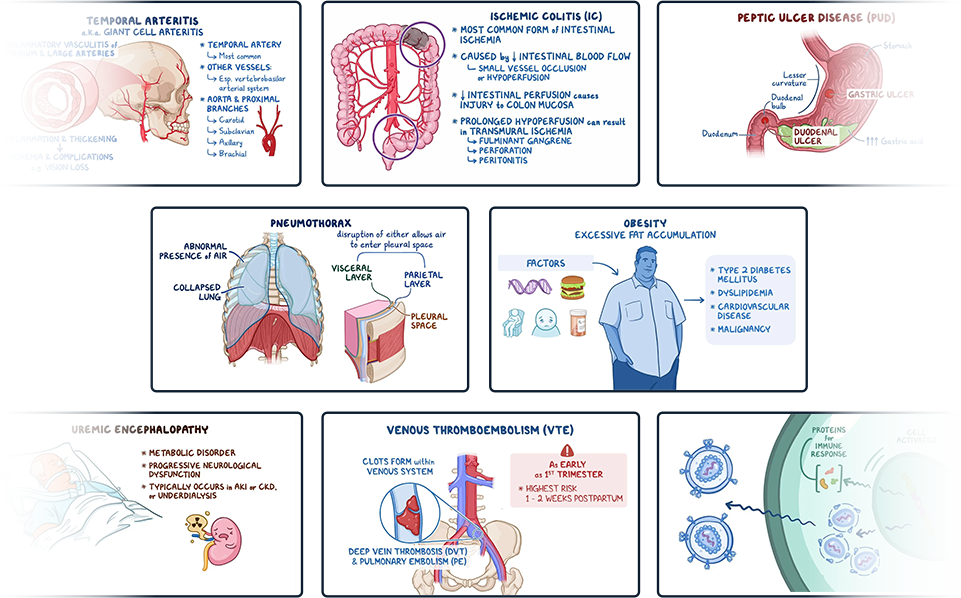 banner of Osmosis videos covering key medical topics