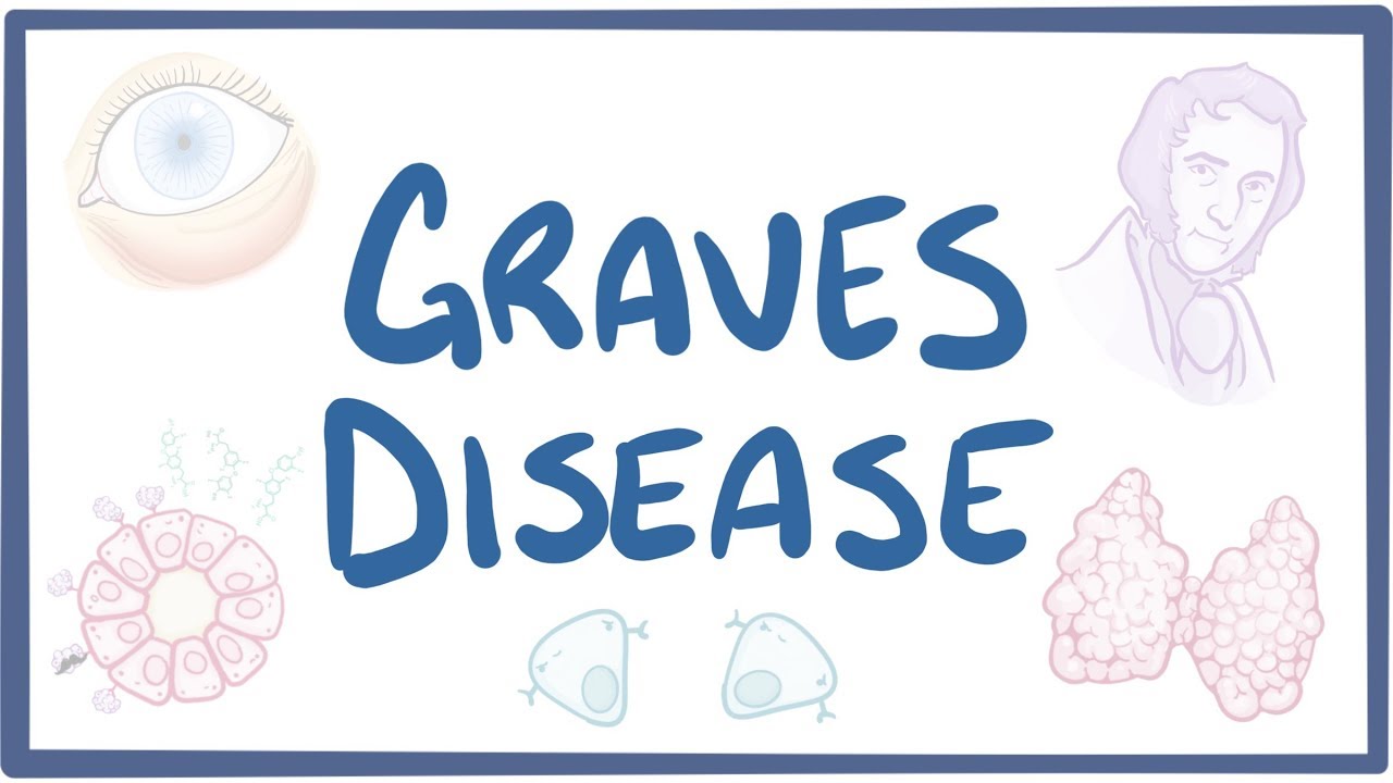 Graves' disease Video, Anatomy, Definition & Function Osmosis