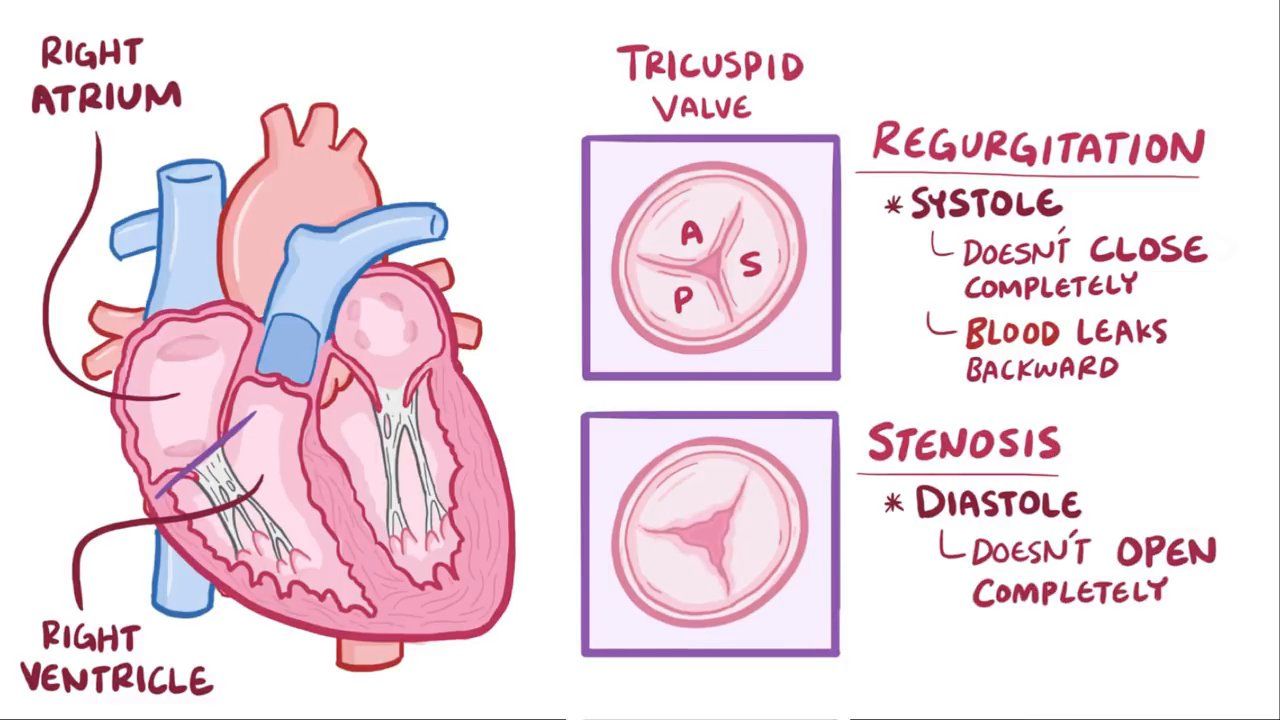 Tricuspid Valve Overview Function And Anatomy 50 OFF
