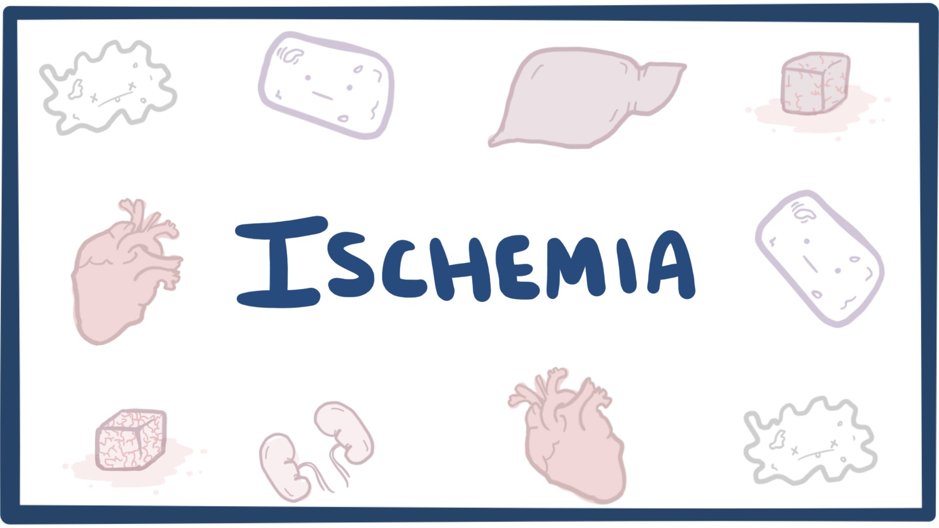 ischemic-stroke-causes-signs-symptoms-ischemic-stroke-treatment
