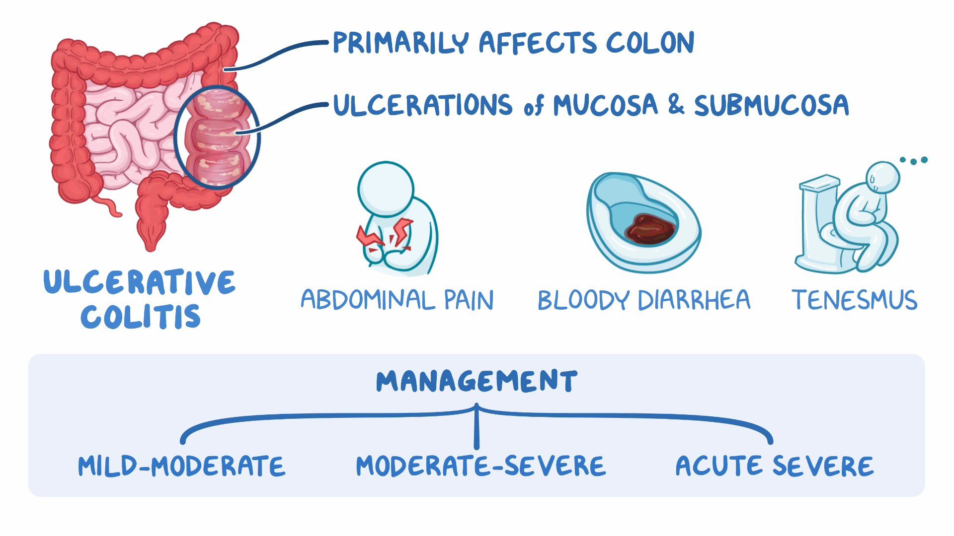 Ulcerative Colitis Symptoms Causes Types And 48 OFF