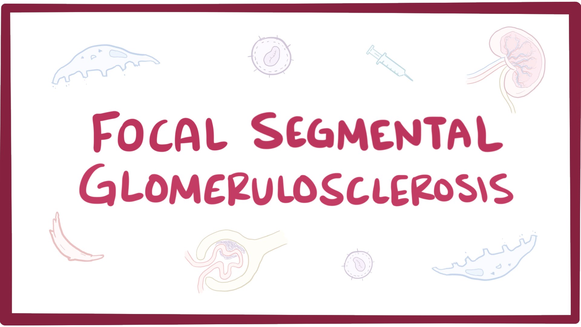 fokal segmentell glomeruloskleros fokal segmentell glomeruloskleros