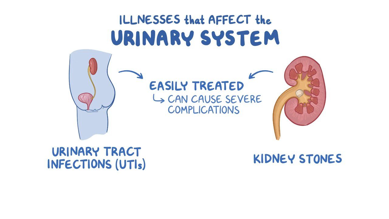 Urinary System Infections And Stones Osmosis Video Library 3463