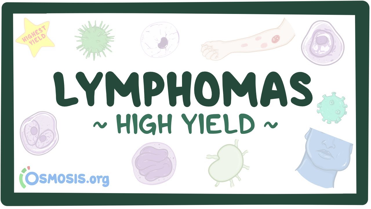 Linfomas: revisión patológica: Vídeo & Anatomía | Osmosis