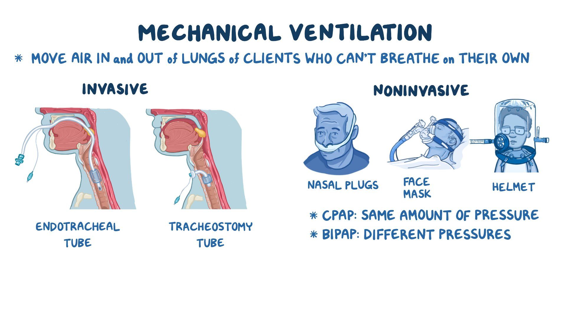 Encommium Incorporare Membro Invasive Ventilation Types Danubio Calmati