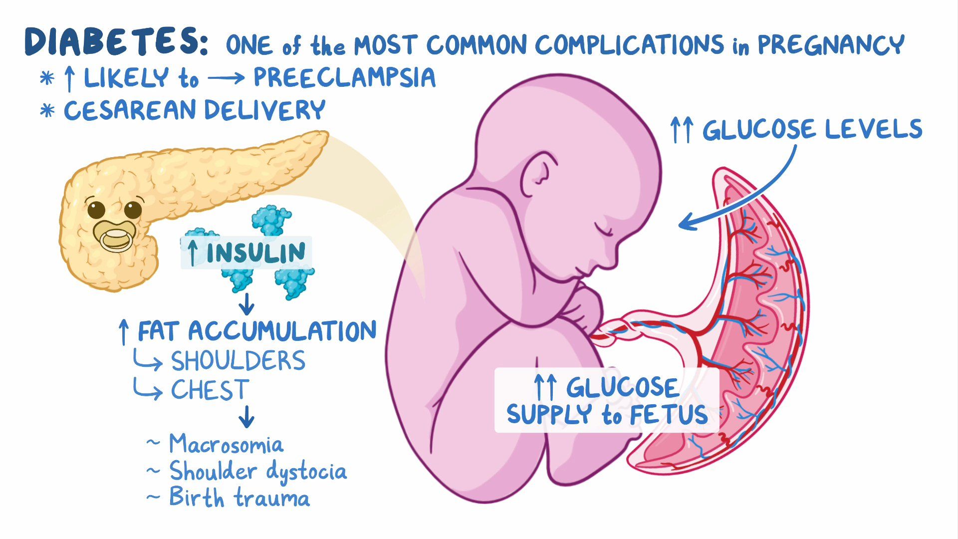 Approach To Diabetes In Pregnancy Clinical Sciences Osmosis Video 
