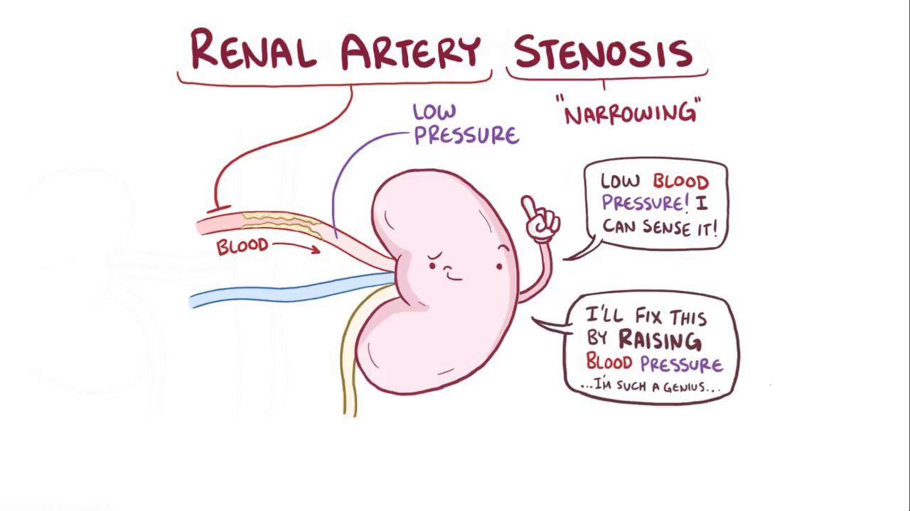 Renal Artery