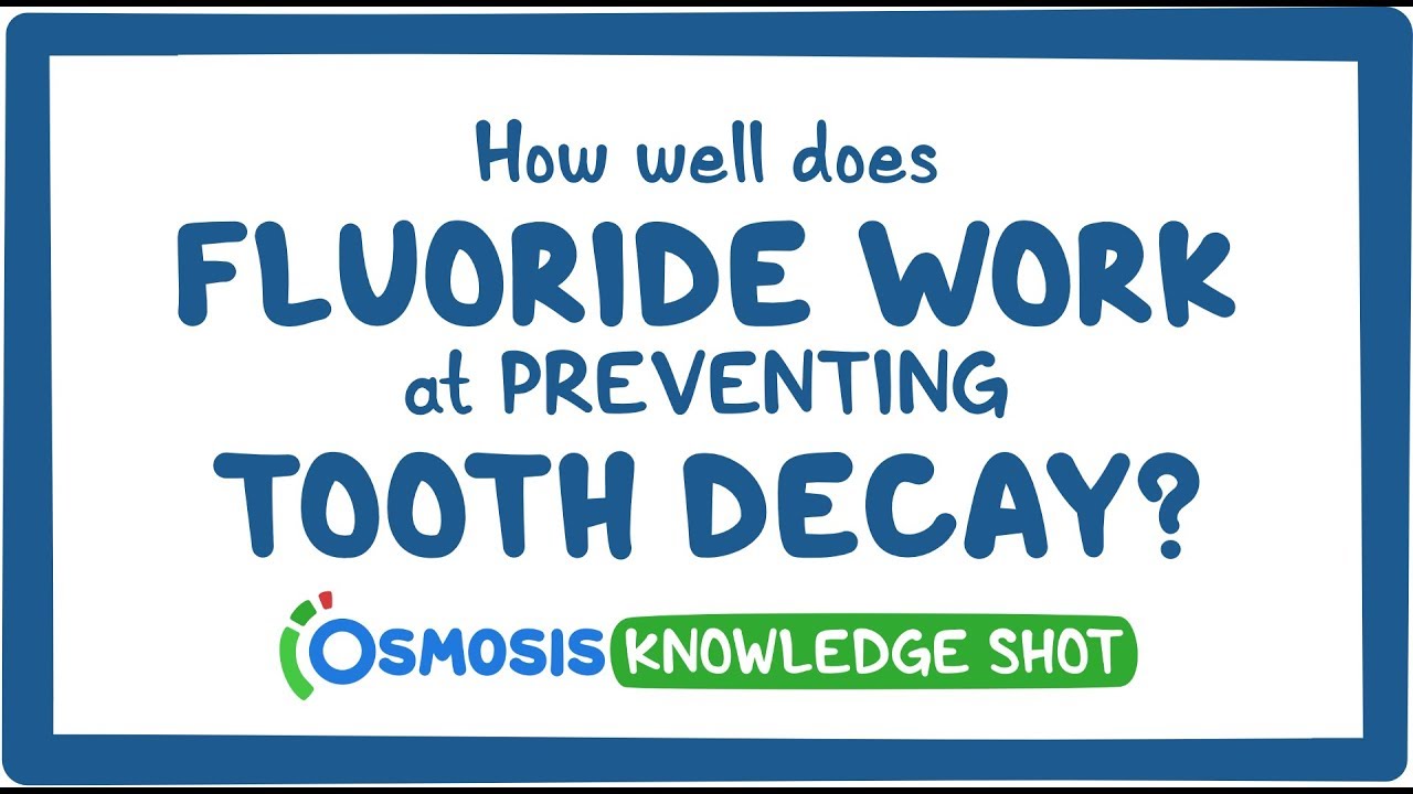 Knowledge Shot How well do fluoride treatments work at preventing tooth decay Osmosis Video
