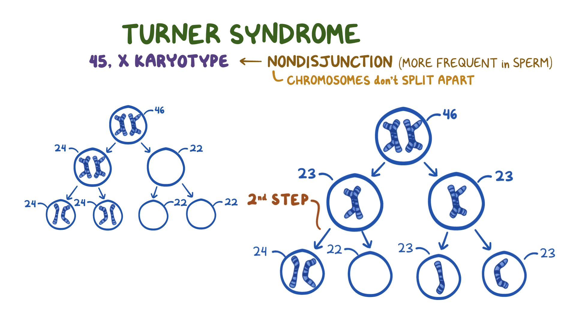 Turner Syndrome Year Of The Zebra Video Anatomy Osmosis Turner Syndrome Year Of The Zebra Video Anatomy Osmosis