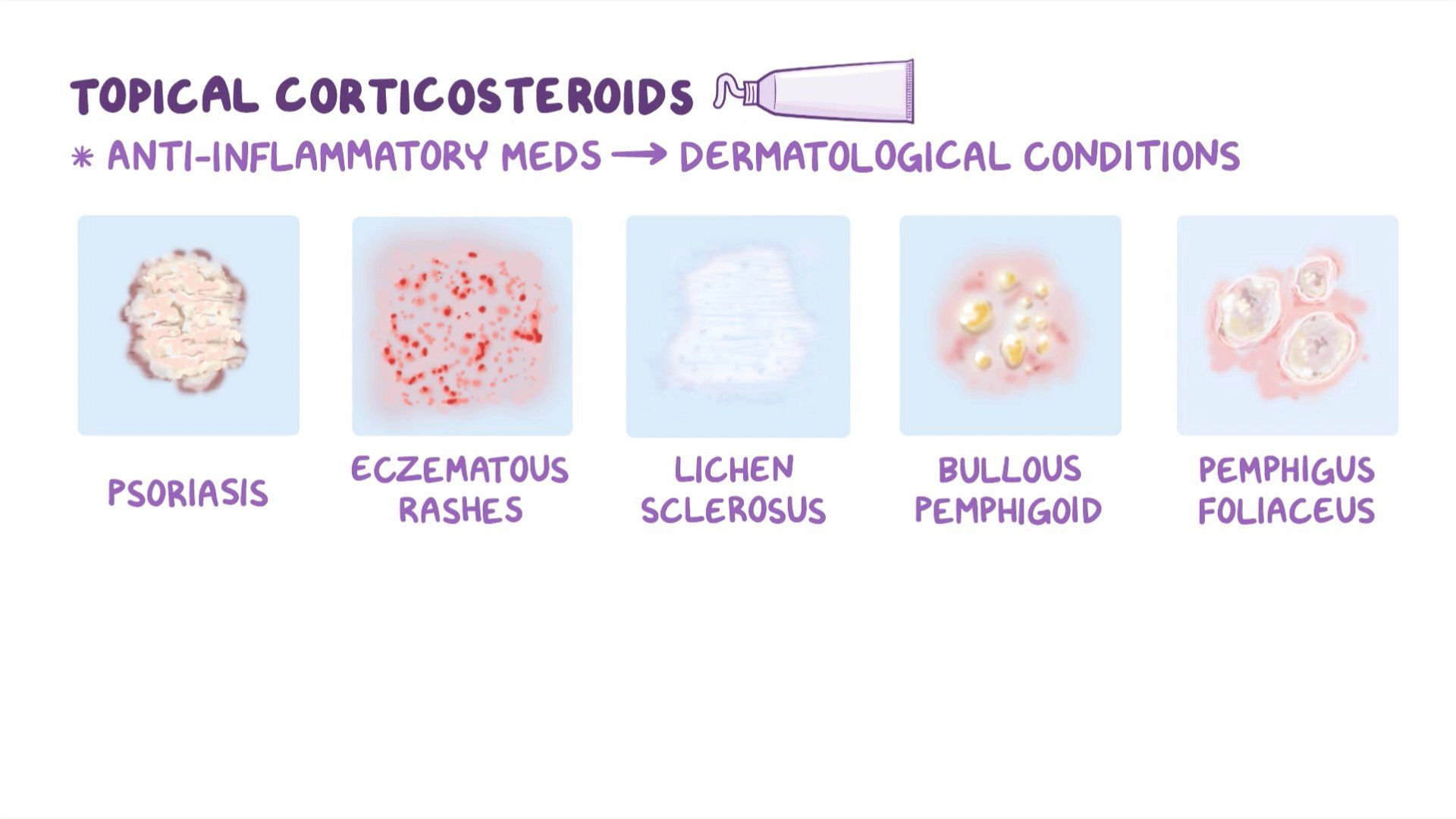 Corticosteroids