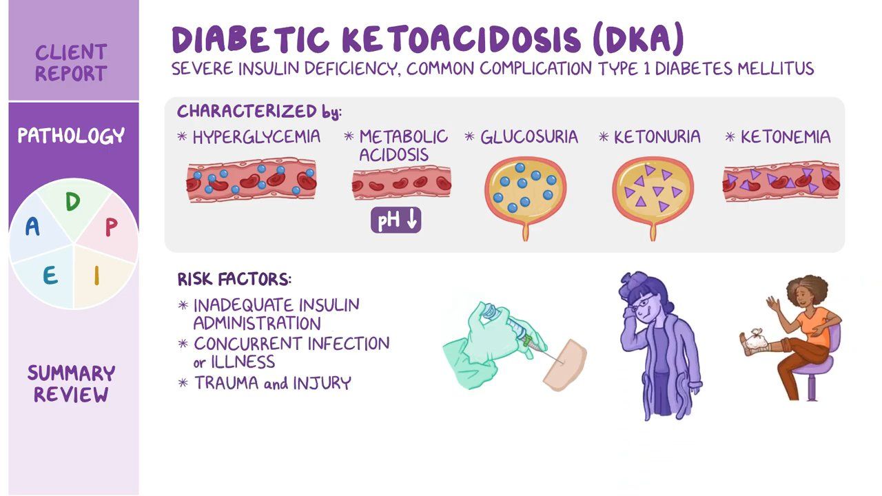 Diabetic Ketoacidosis DKA Nursing Process ADPIE Osmosis Video 