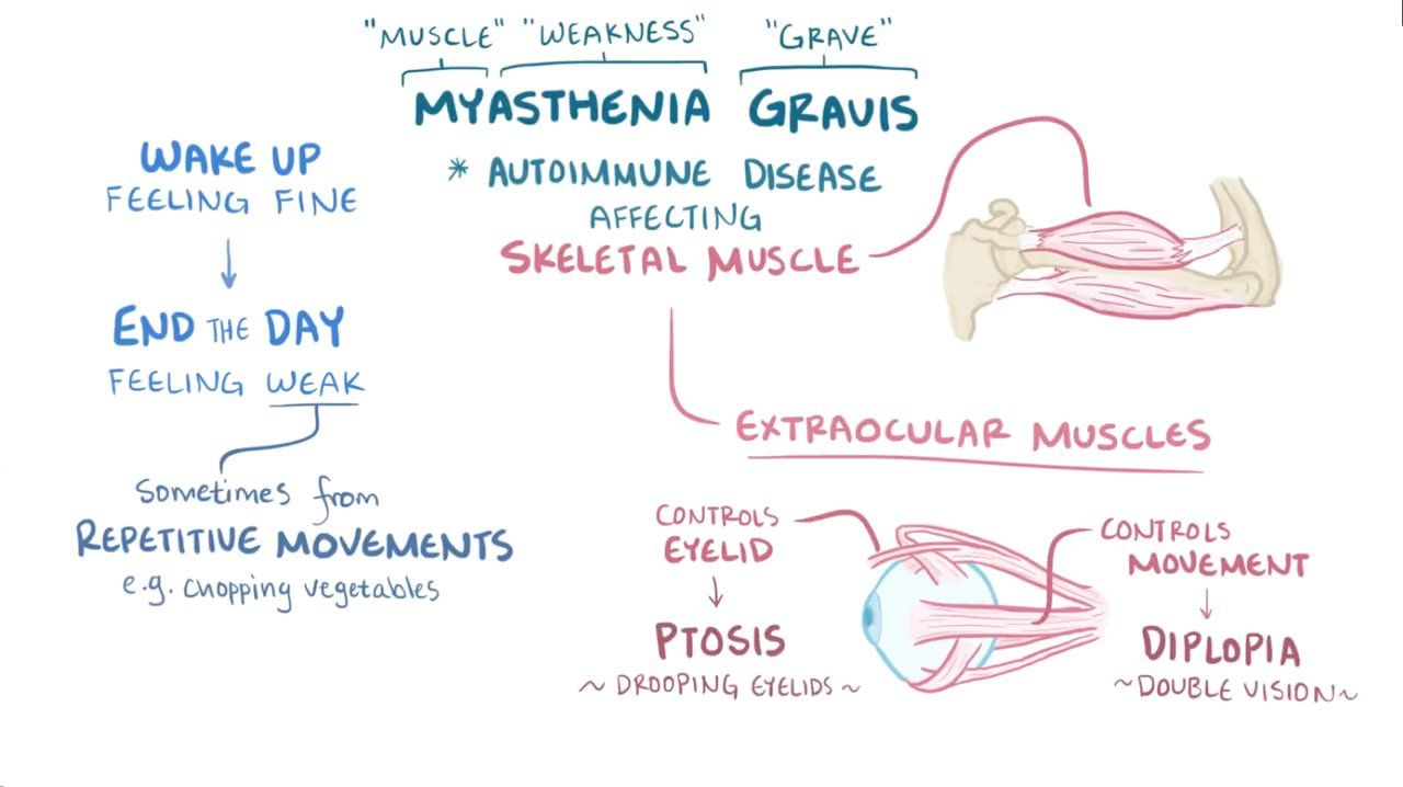 Generalized Myasthenia Gravis KRCTV Generalized Myasthenia Gravis KRCTV