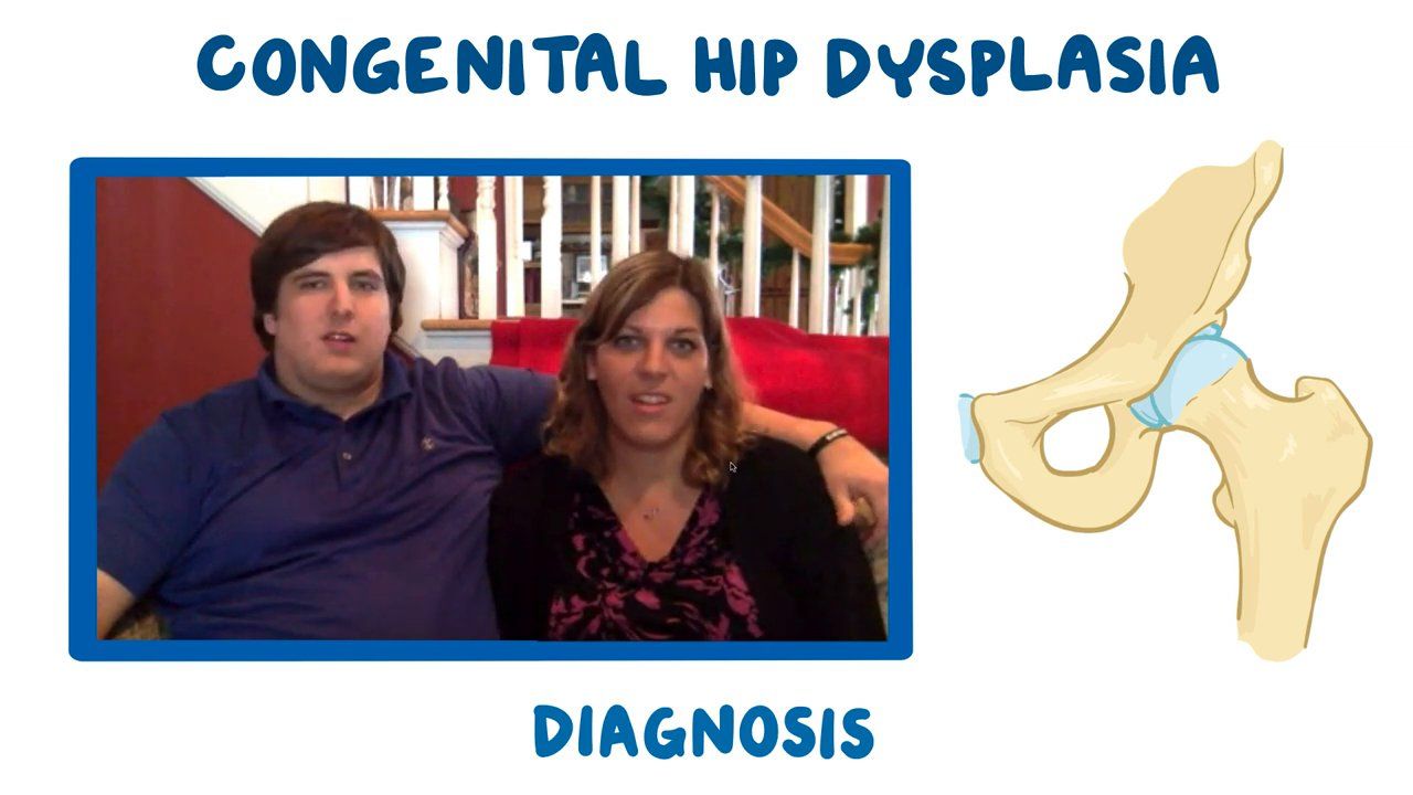 Patients Perspective Congenital Hip Dysplasia Osmosis Video Library