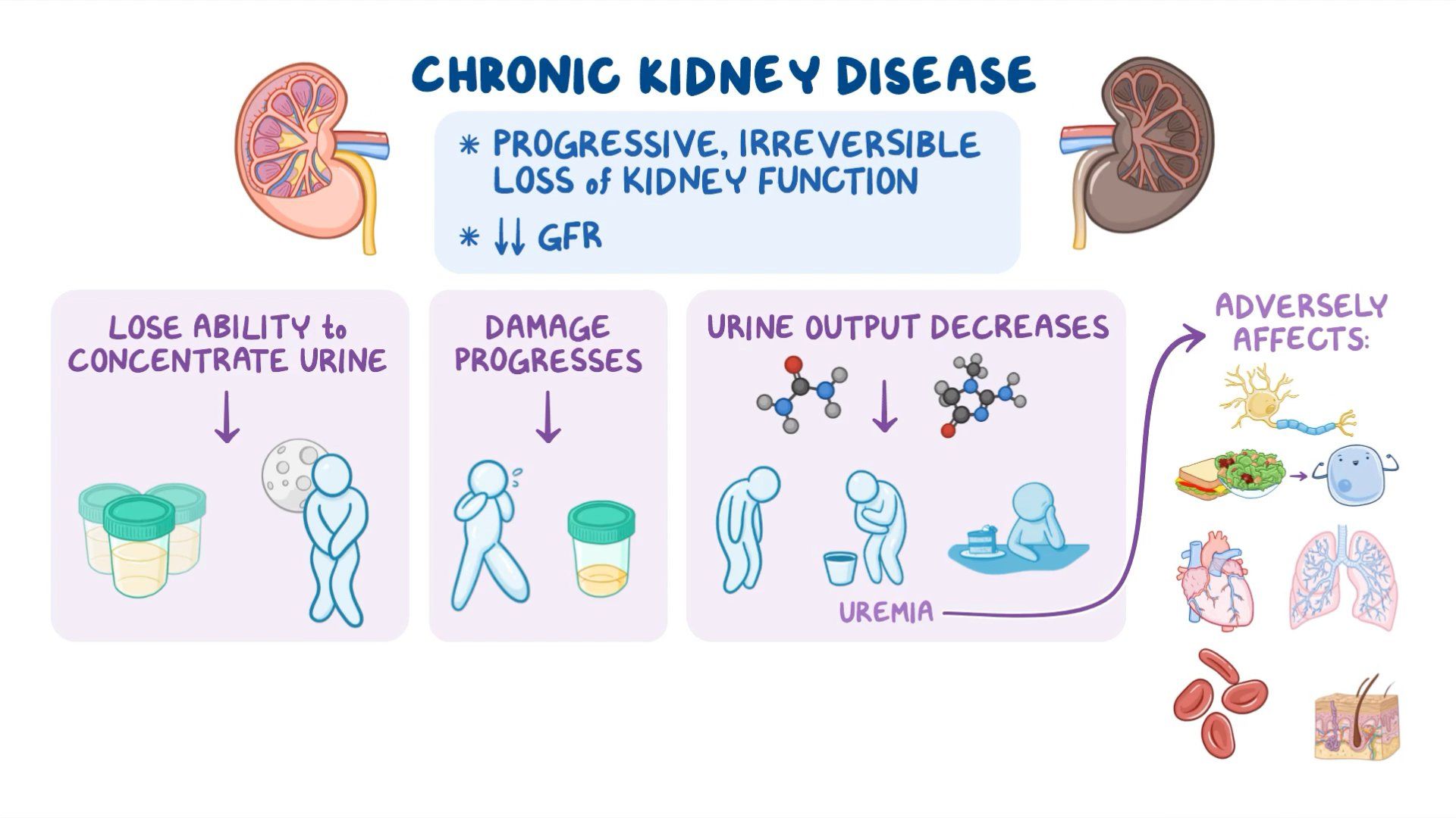 Chronic Kidney Disease