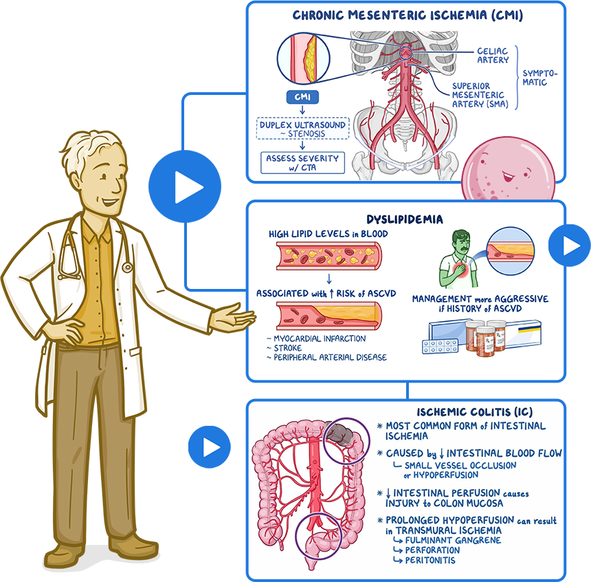 doctor standing with Osmosis video screenshots of CMI, Dyslipidemia and IC