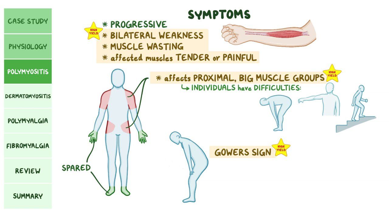 Myositis Symptoms