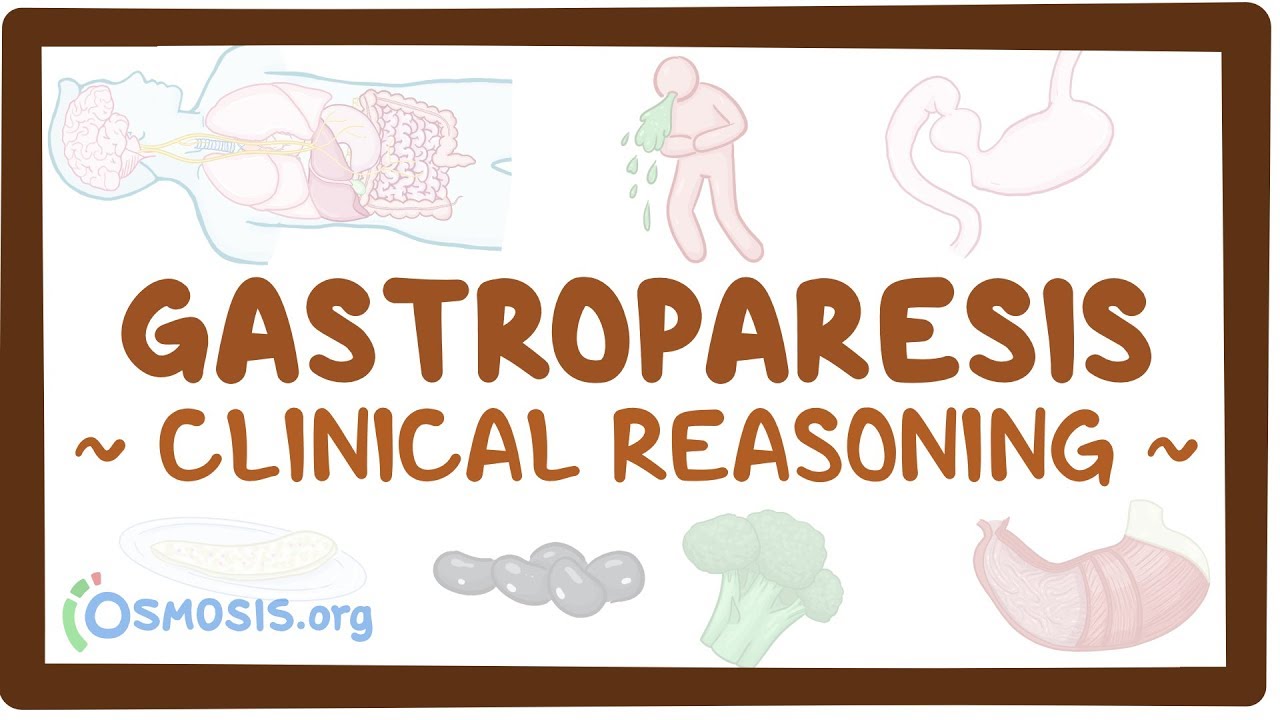 Gastroparesis Clinical Video, Anatomy & Definition Osmosis