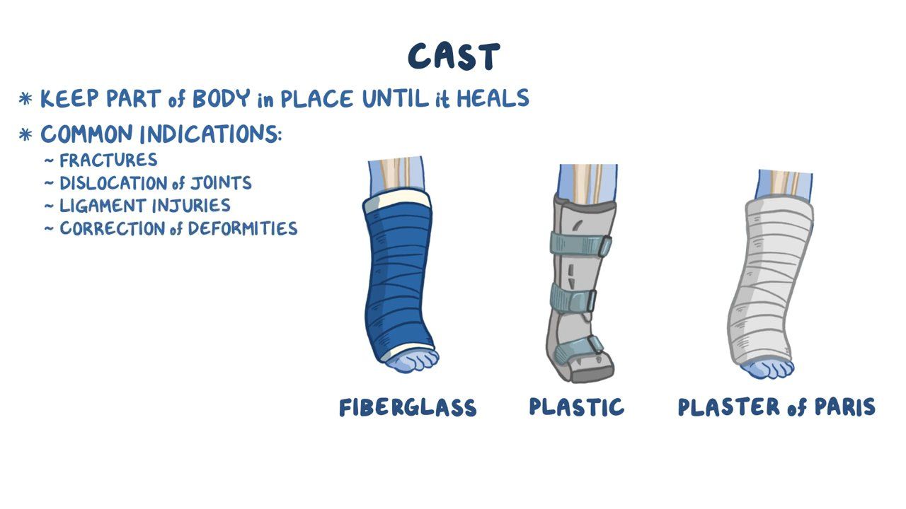 Applying And Caring For A Patient In Skin Traction Flashcards FYVISM Applying And Caring For A Patient In Skin Traction Flashcards FYVISM