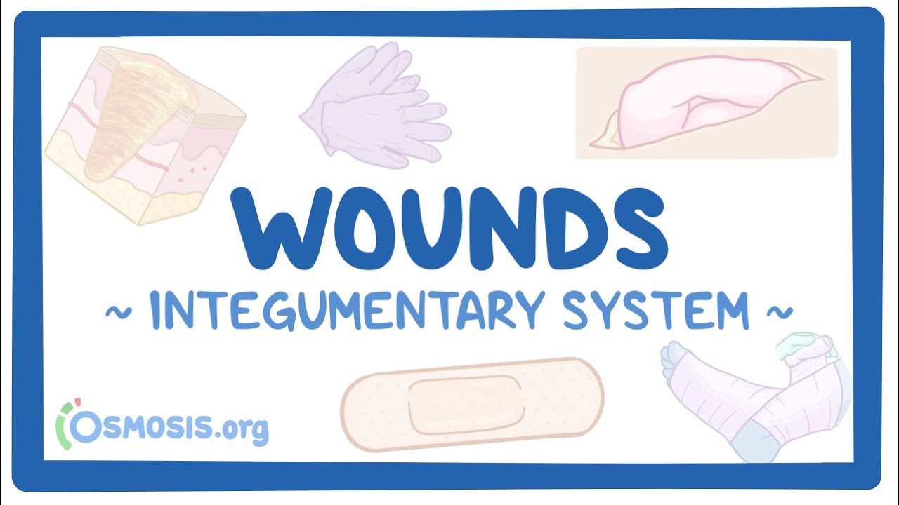 Integumentary system Wounds Osmosis Video Library