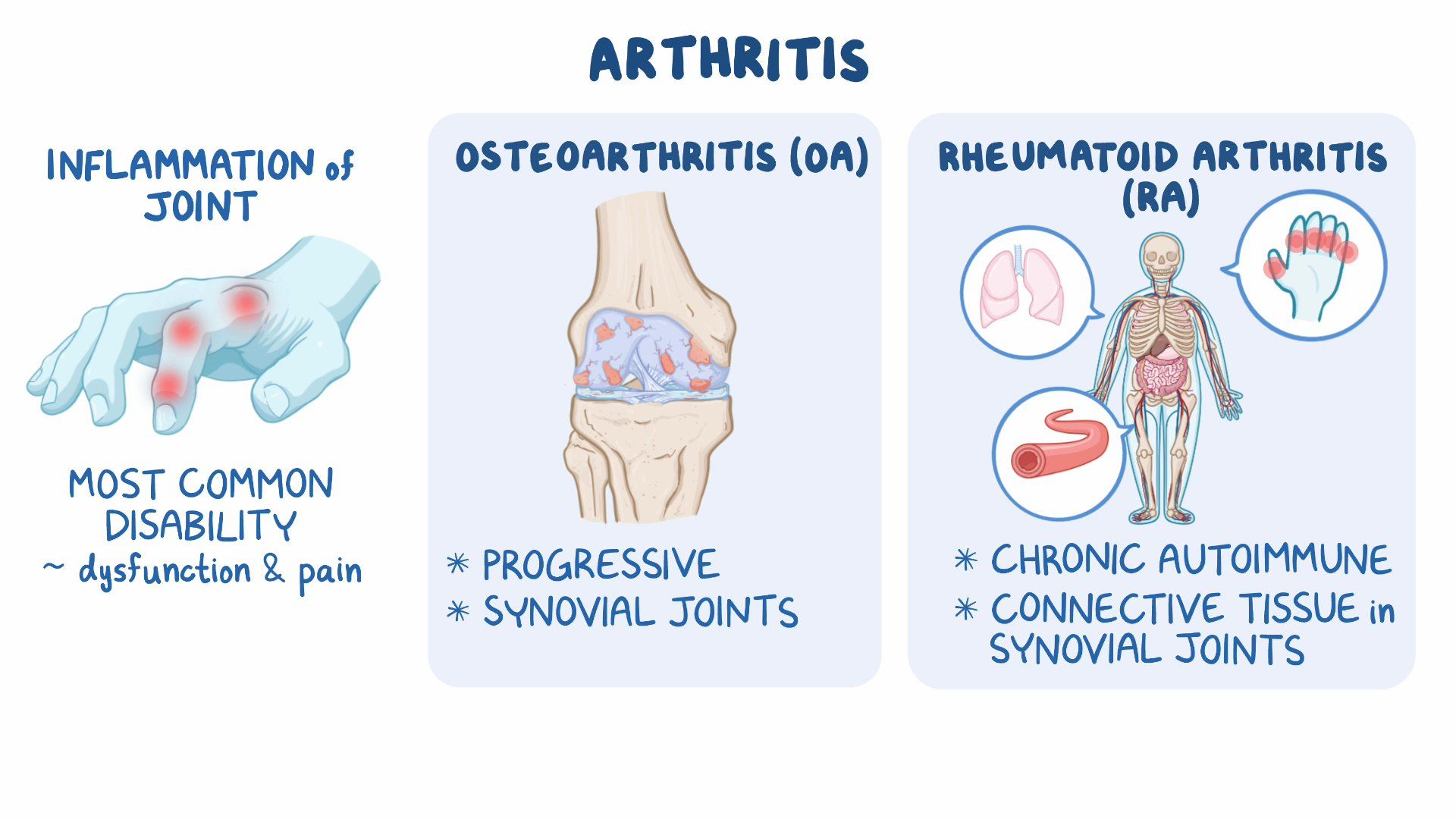 Nursing Care For Arthritis Osmosis Video Library
