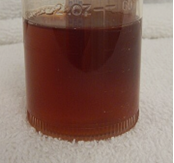 dark urine