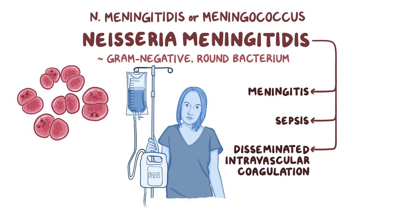 Neisseria Meningitidis Video Anatomy Definition Osmosis