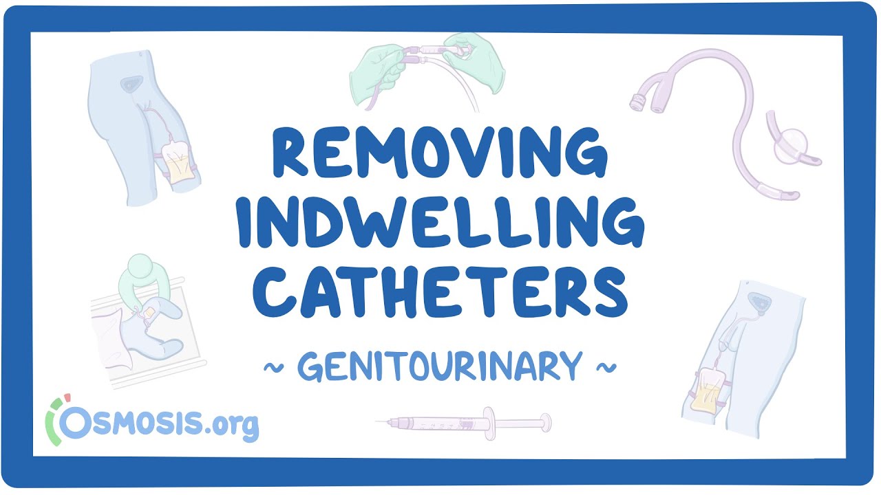 Genitourinary Removing indwelling catheters (for nursing assistant training) Osmosis Video