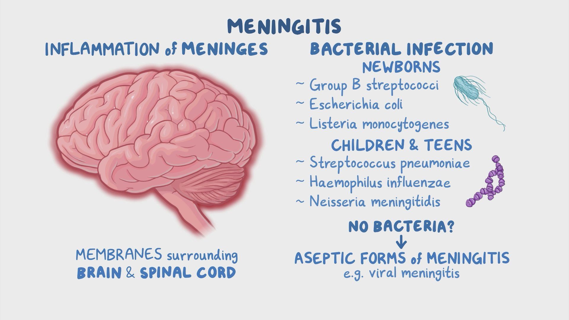 Meningitis pediatrics Clinical Sciences Osmosis Video Library