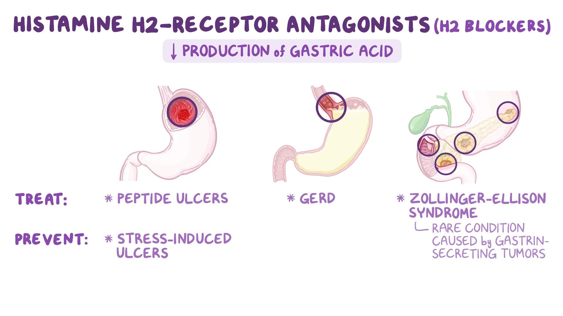 Histamine H2 Antagonists Nursing Pharmacology Osmosis Video Library