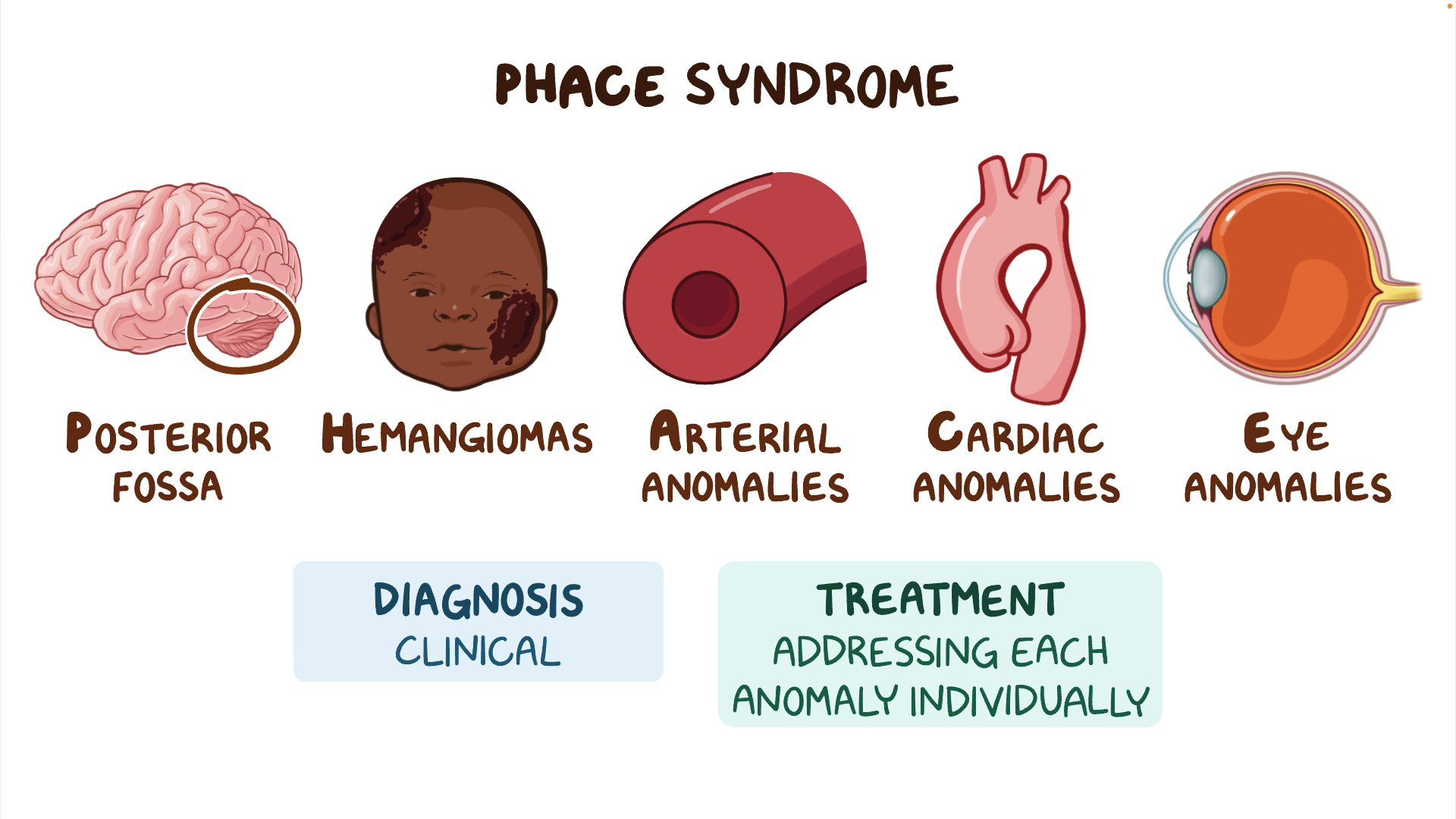 PHACE syndrome Year of the Zebra Video & Anatomy Osmosis