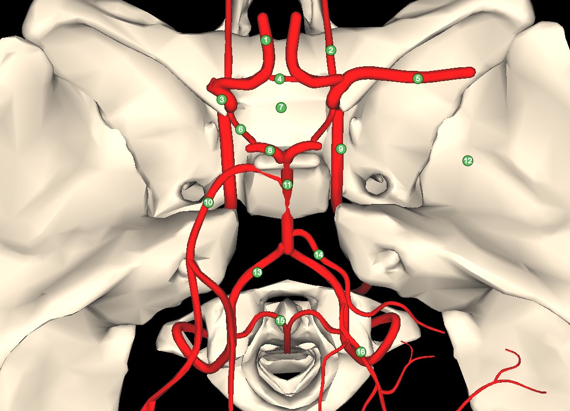 Superior cerebellar artery | Osmosis
